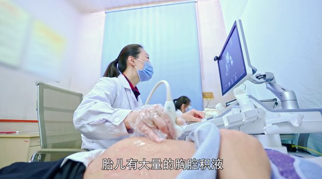 胎儿胸腔积液生要多久_胎儿胸腔积液生要剖腹产吗_快要生了胎儿胸腔积液